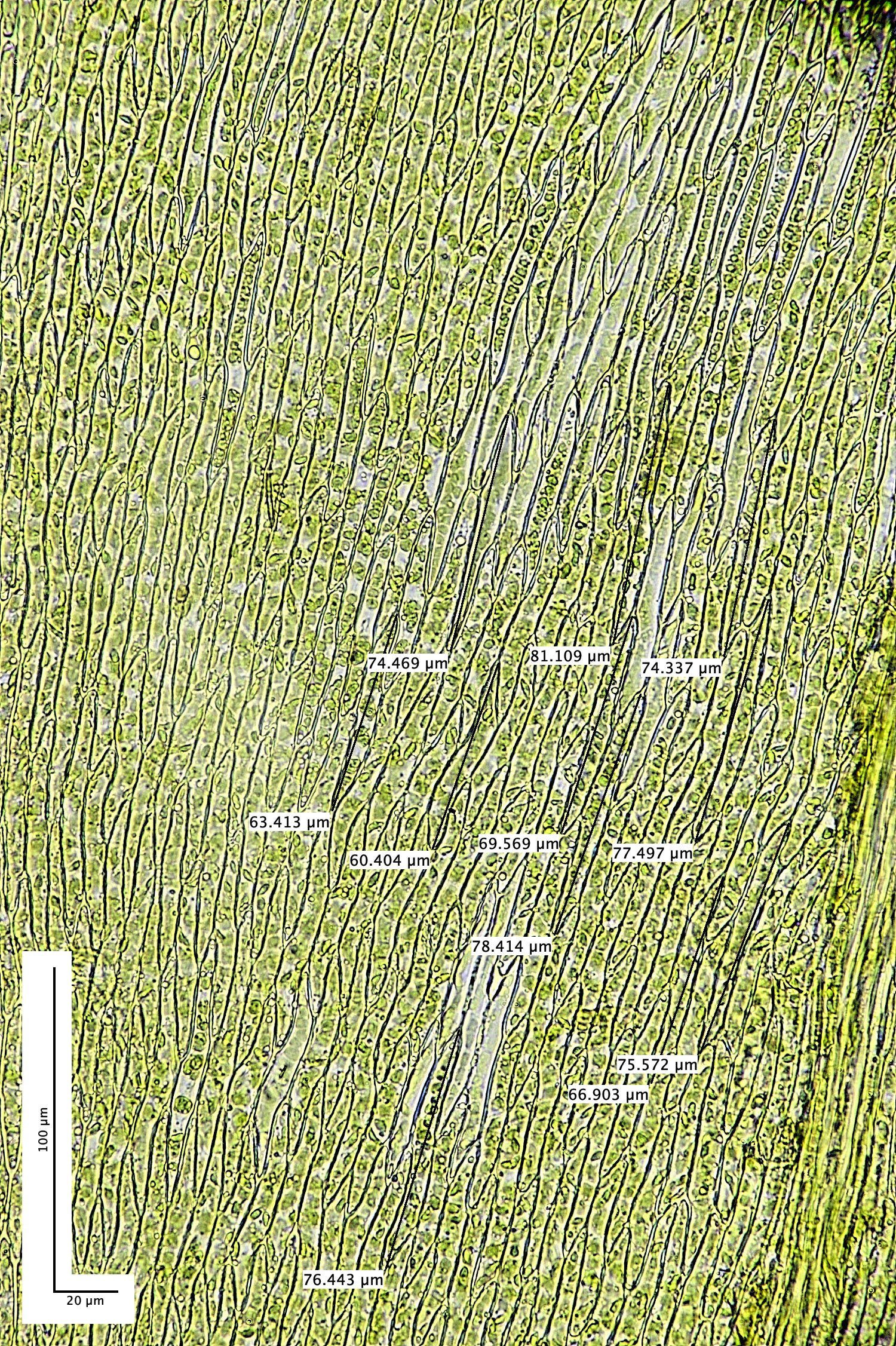TheNarboroughsOxyrrhynchiumSp300326-1fM
