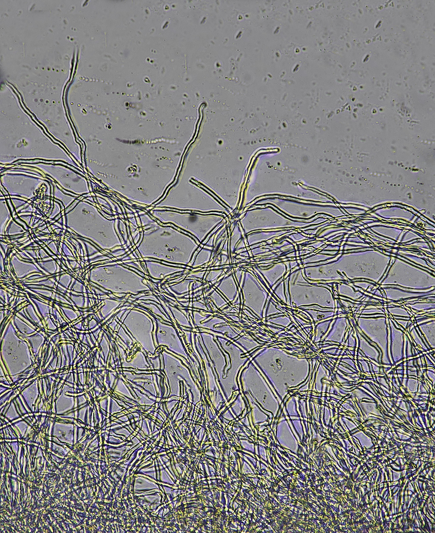 WoltertoElfCup220226-5
