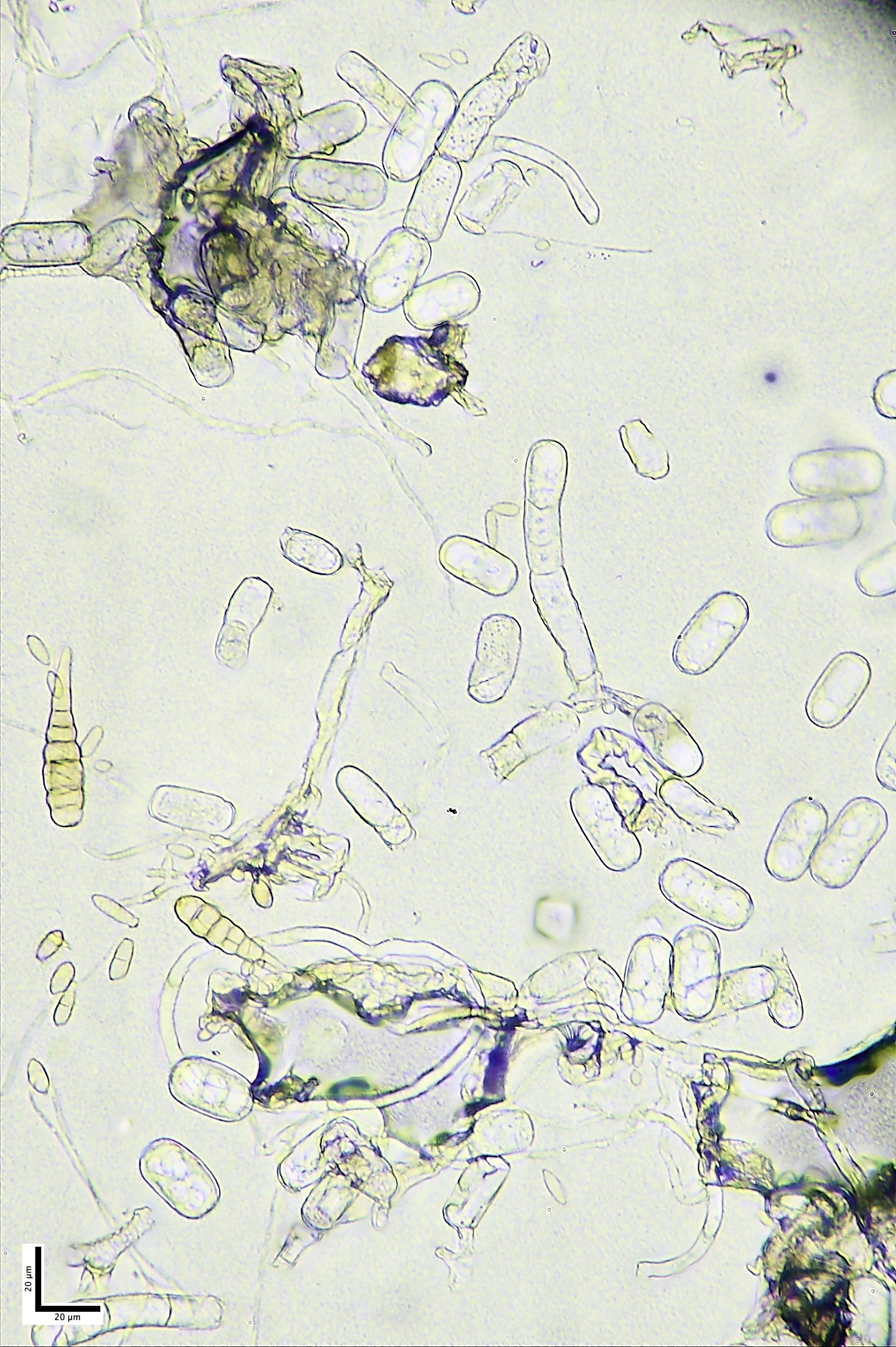 HolkhamMildew180926-3M