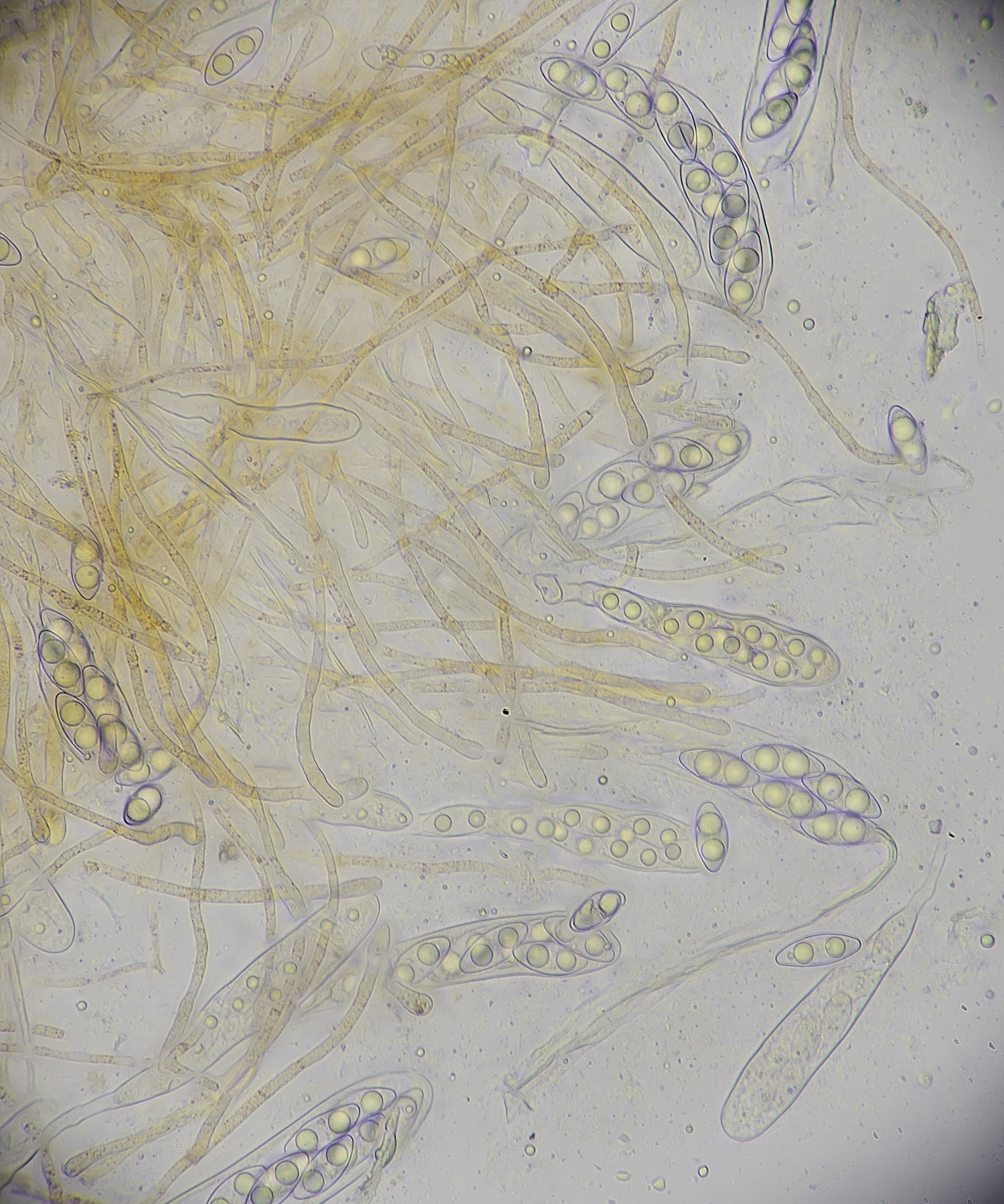 WaveneyForestOctospora010226-1